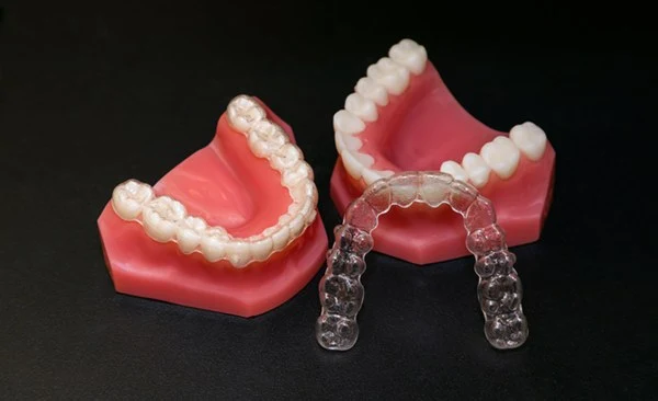 인비절라인 교정 장치와 치아 모형 / Invisalign aligner and dental model showing clear orthodontic appliance