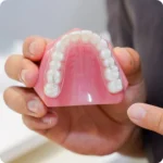 인비절라인 장착 예시가 표시된 치아 모형 / Dental model demonstrating Invisalign placement for clear aligner orthodontics